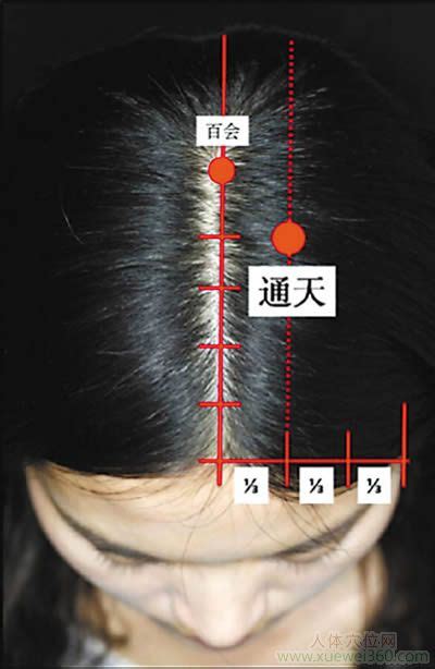 通天穴|通天穴的准确位置图和作用